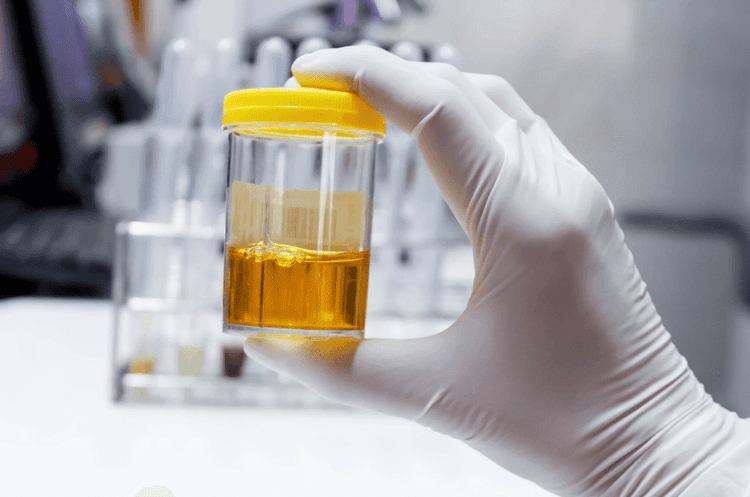 Understanding the Urine Microbiome