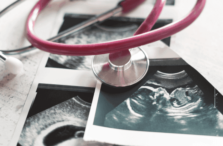 Det vaginale mikrobioms rolle i graviditet og spontanabort