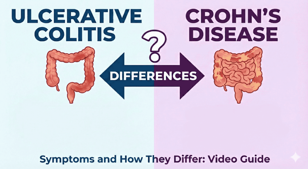 Ulcerative Colitis Symptoms & How They Differ From Crohn’s Disease
