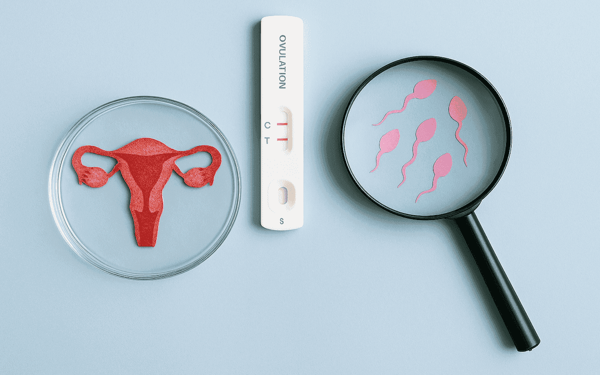 Endometriose og infertilitet: forstå den skjulte forbindelse
